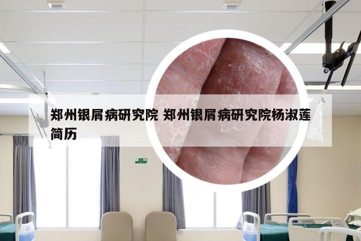 郑州银屑病研究院 郑州银屑病研究院杨淑莲简历