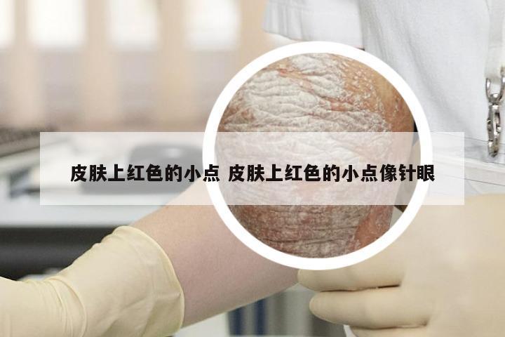 皮肤上红色的小点 皮肤上红色的小点像针眼