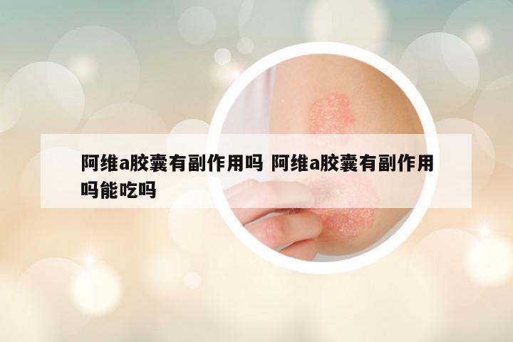 阿维a胶囊有副作用吗 阿维a胶囊有副作用吗能吃吗