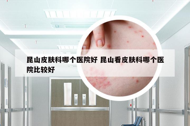 昆山皮肤科哪个医院好 昆山看皮肤科哪个医院比较好