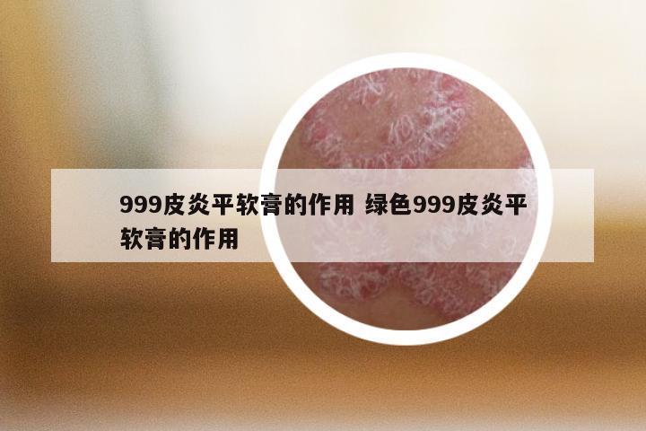 999皮炎平软膏的作用 绿色999皮炎平软膏的作用