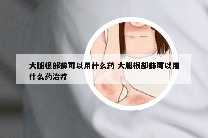 大腿根部藓可以用什么药 大腿根部藓可以用什么药治疗