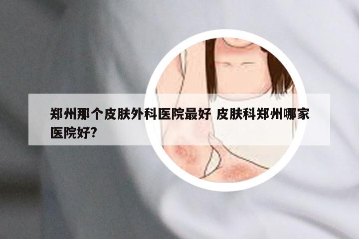 郑州那个皮肤外科医院最好 皮肤科郑州哪家医院好?