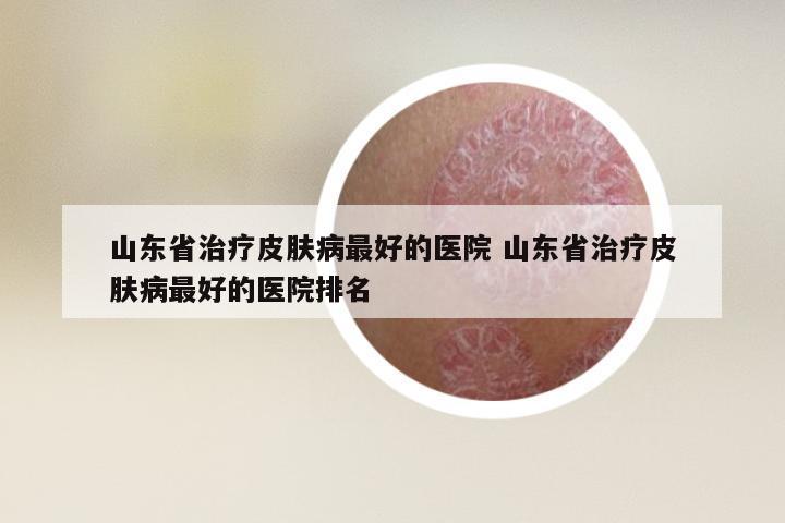 山东省治疗皮肤病最好的医院 山东省治疗皮肤病最好的医院排名