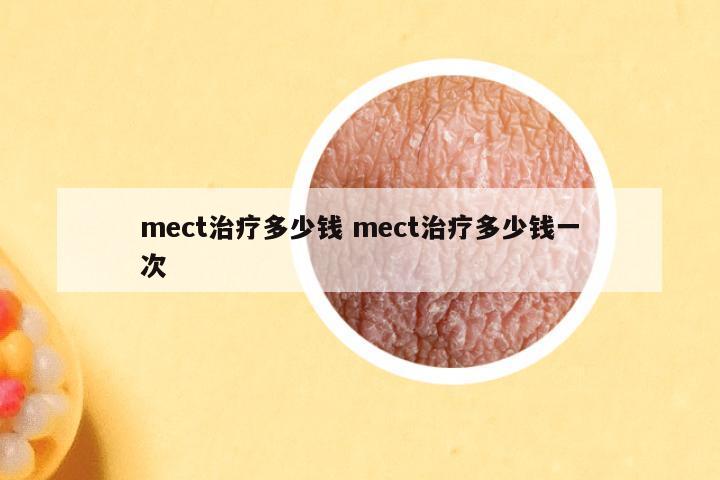 mect治疗多少钱 mect治疗多少钱一次