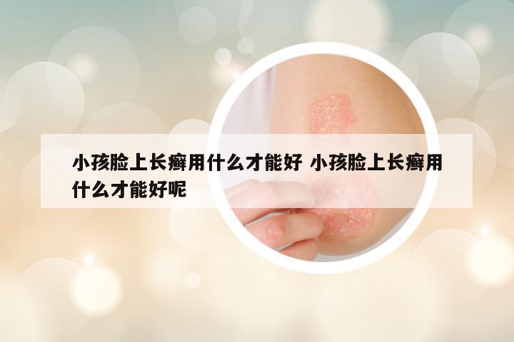 小孩脸上长癣用什么才能好 小孩脸上长癣用什么才能好呢