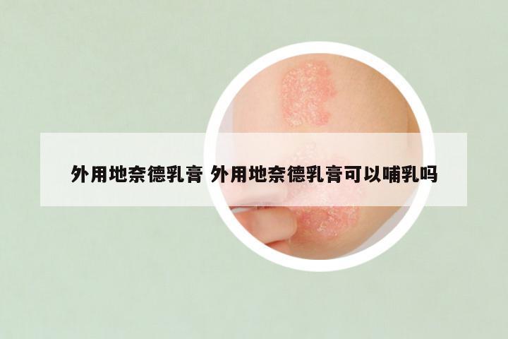 外用地奈德乳膏 外用地奈德乳膏可以哺乳吗