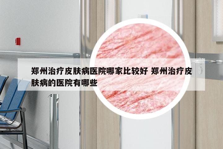 郑州治疗皮肤病医院哪家比较好 郑州治疗皮肤病的医院有哪些