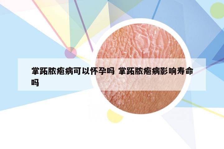 掌跖脓疱病可以怀孕吗 掌跖脓疱病影响寿命吗