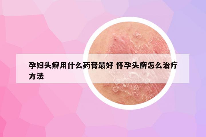 孕妇头癣用什么药膏最好 怀孕头癣怎么治疗方法