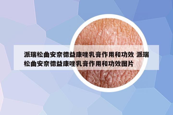 派瑞松曲安奈德益康唑乳膏作用和功效 派瑞松曲安奈德益康唑乳膏作用和功效图片