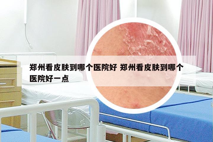 郑州看皮肤到哪个医院好 郑州看皮肤到哪个医院好一点