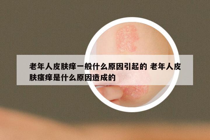 老年人皮肤痒一般什么原因引起的 老年人皮肤瘙痒是什么原因造成的