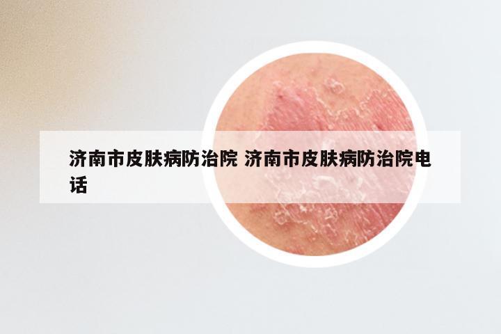 济南市皮肤病防治院 济南市皮肤病防治院电话
