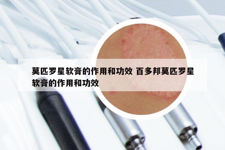 莫匹罗星软膏的作用和功效 百多邦莫匹罗星软膏的作用和功效
