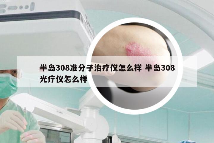 半岛308准分子治疗仪怎么样 半岛308光疗仪怎么样