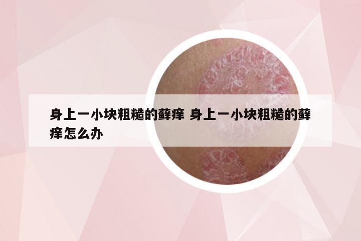 身上一小块粗糙的藓痒 身上一小块粗糙的藓痒怎么办
