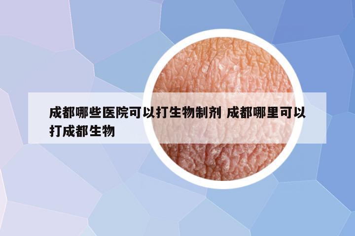 成都哪些医院可以打生物制剂 成都哪里可以打成都生物