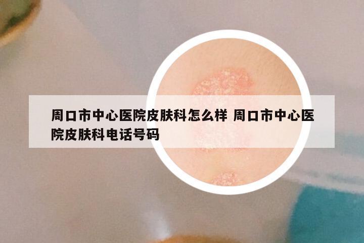 周口市中心医院皮肤科怎么样 周口市中心医院皮肤科电话号码