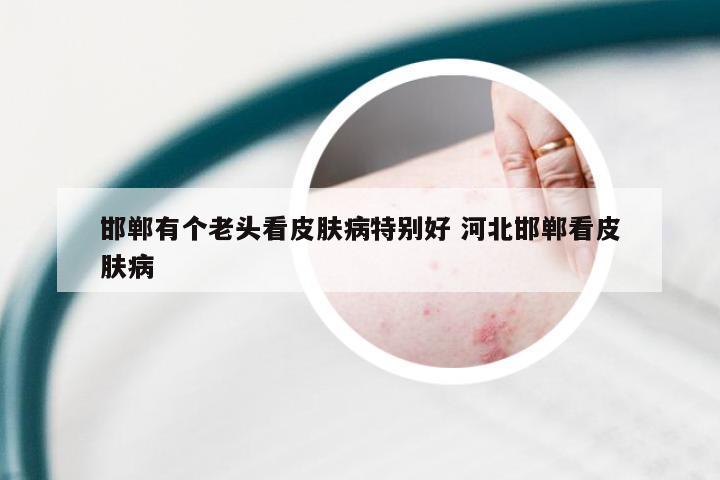 邯郸有个老头看皮肤病特别好 河北邯郸看皮肤病