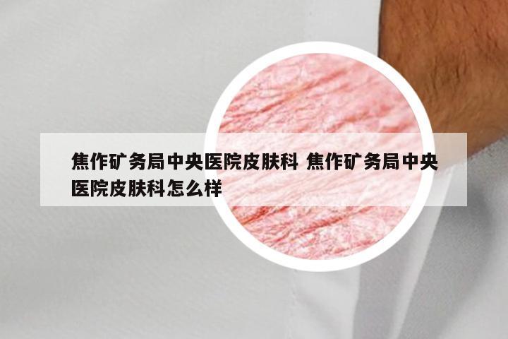 焦作矿务局中央医院皮肤科 焦作矿务局中央医院皮肤科怎么样