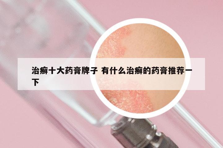 治癣十大药膏牌子 有什么治癣的药膏推荐一下