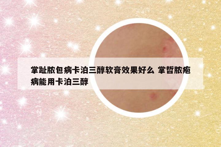 掌趾脓包病卡泊三醇软膏效果好么 掌哲脓疱病能用卡泊三醇
