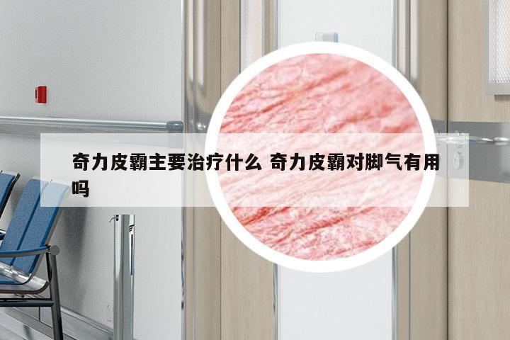 奇力皮霸主要治疗什么 奇力皮霸对脚气有用吗