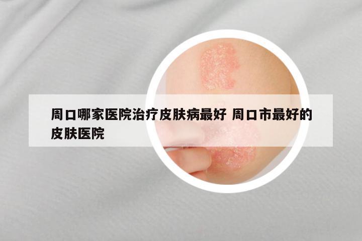 周口哪家医院治疗皮肤病最好 周口市最好的皮肤医院