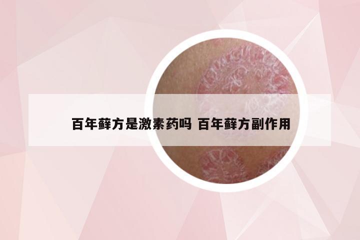 百年藓方是激素药吗 百年藓方副作用