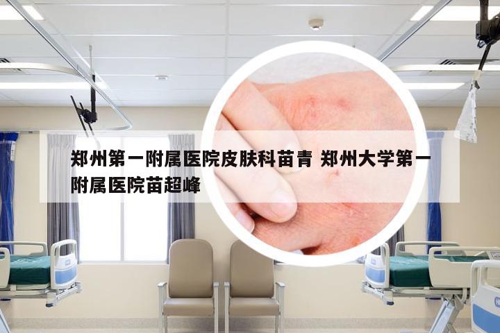 郑州第一附属医院皮肤科苗青 郑州大学第一附属医院苗超峰