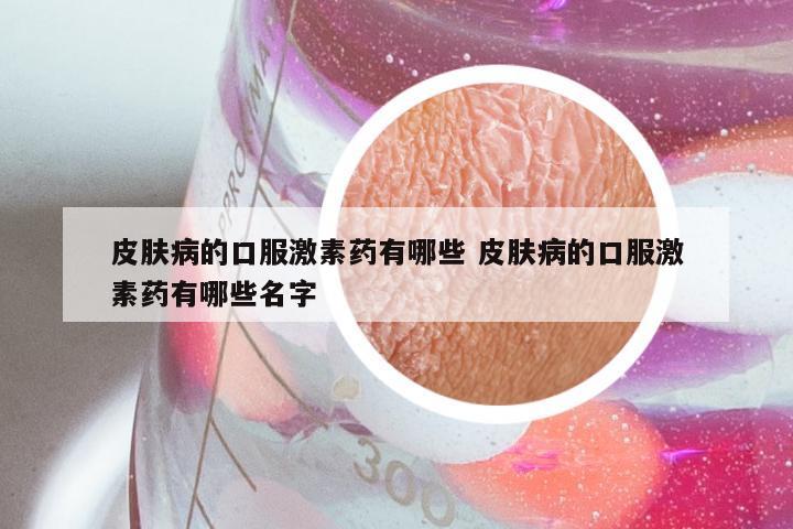 皮肤病的口服激素药有哪些 皮肤病的口服激素药有哪些名字