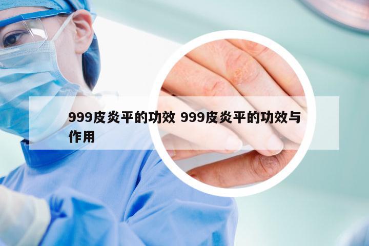 999皮炎平的功效 999皮炎平的功效与作用