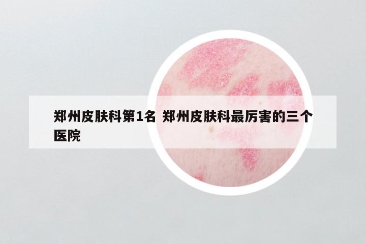 郑州皮肤科第1名 郑州皮肤科最厉害的三个医院
