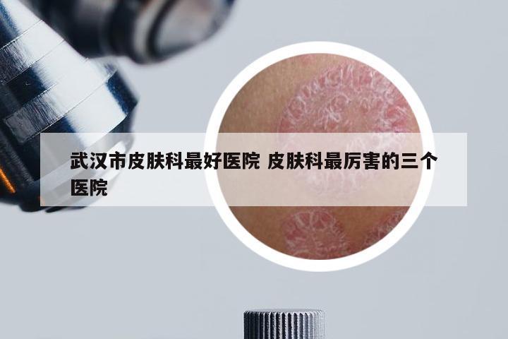武汉市皮肤科最好医院 皮肤科最厉害的三个医院