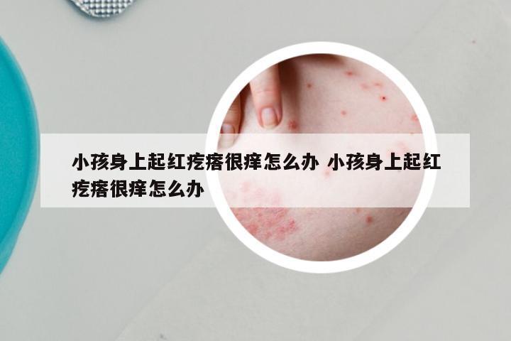 小孩身上起红疙瘩很痒怎么办 小孩身上起红疙瘩很痒怎么办