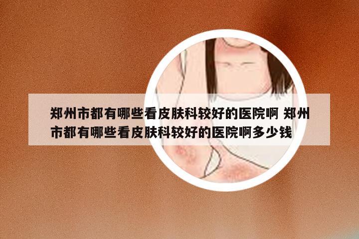 郑州市都有哪些看皮肤科较好的医院啊 郑州市都有哪些看皮肤科较好的医院啊多少钱