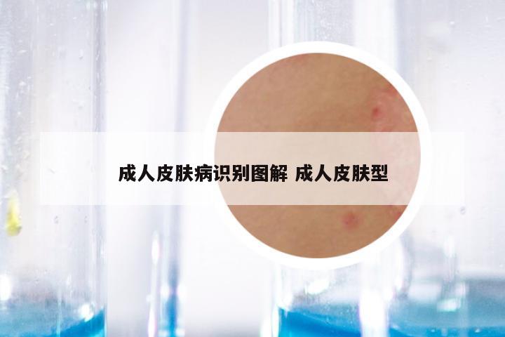 成人皮肤病识别图解 成人皮肤型