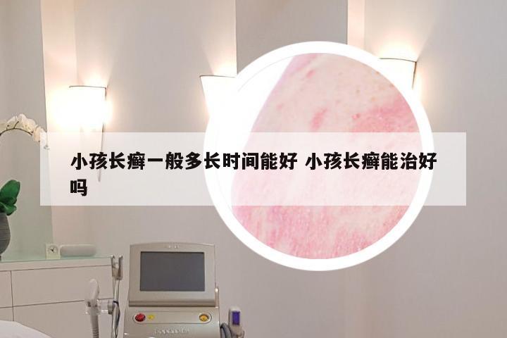 小孩长癣一般多长时间能好 小孩长癣能治好吗