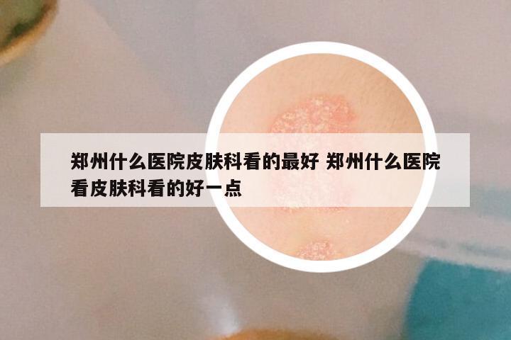 郑州什么医院皮肤科看的最好 郑州什么医院看皮肤科看的好一点