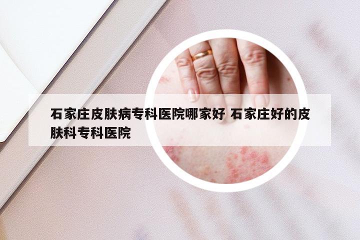 石家庄皮肤病专科医院哪家好 石家庄好的皮肤科专科医院