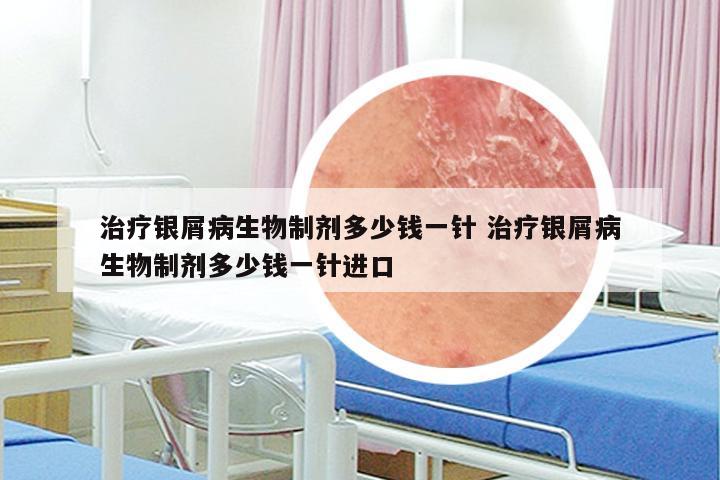 治疗银屑病生物制剂多少钱一针 治疗银屑病生物制剂多少钱一针进口