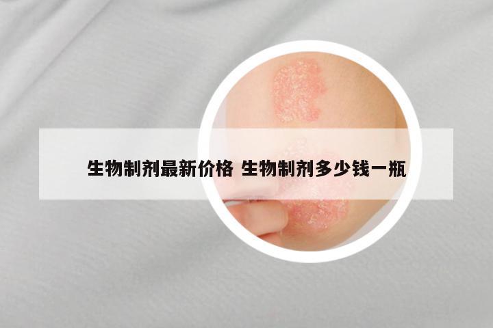 生物制剂最新价格 生物制剂多少钱一瓶