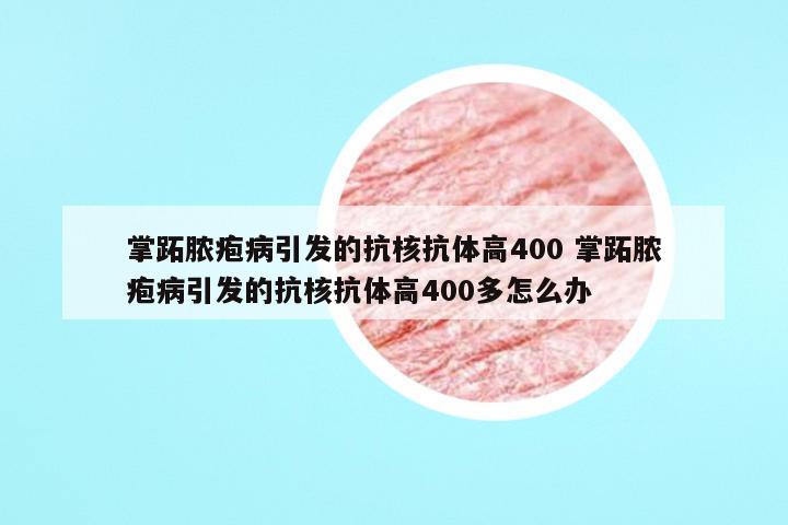 掌跖脓疱病引发的抗核抗体高400 掌跖脓疱病引发的抗核抗体高400多怎么办