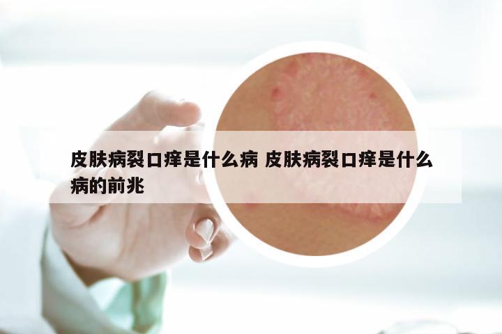 皮肤病裂口痒是什么病 皮肤病裂口痒是什么病的前兆