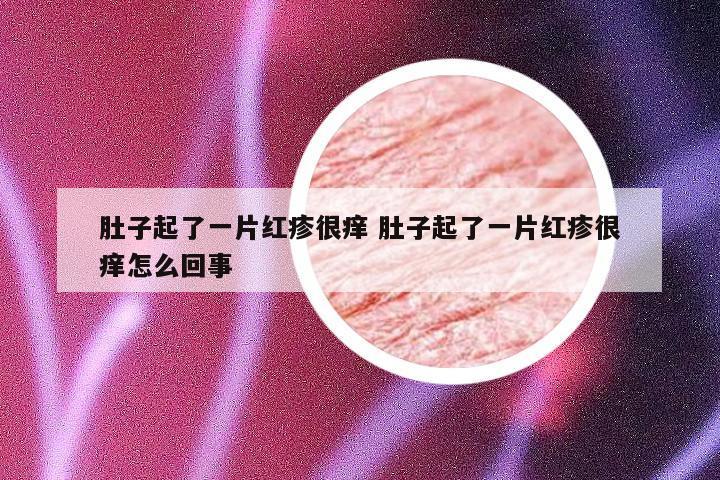 肚子起了一片红疹很痒 肚子起了一片红疹很痒怎么回事