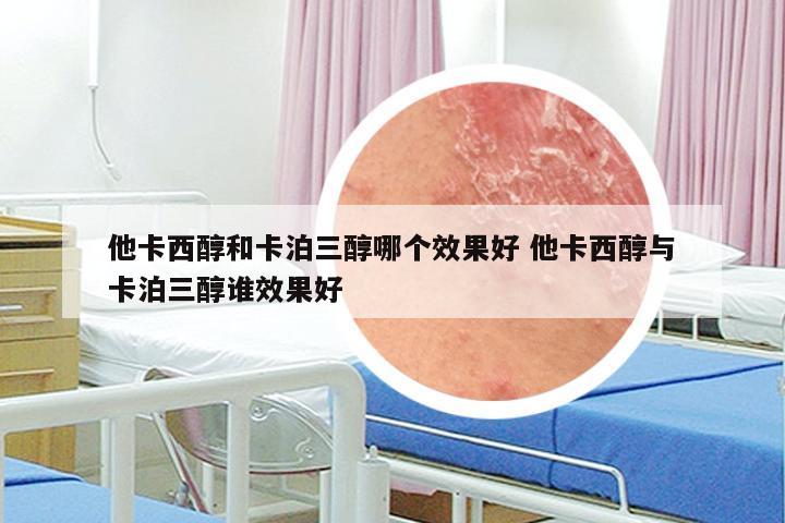 他卡西醇和卡泊三醇哪个效果好 他卡西醇与卡泊三醇谁效果好
