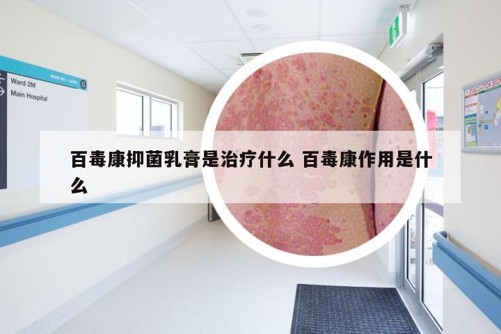 百毒康抑菌乳膏是治疗什么 百毒康作用是什么