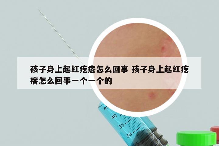 孩子身上起红疙瘩怎么回事 孩子身上起红疙瘩怎么回事一个一个的