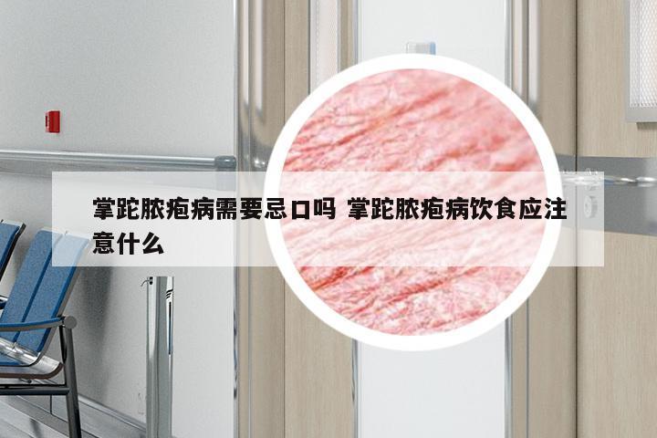 掌跎脓疱病需要忌口吗 掌跎脓疱病饮食应注意什么